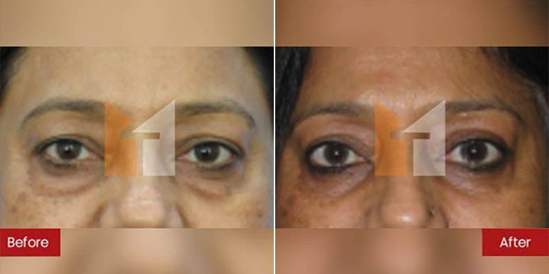 Prof. Dr. Mohan Thomas Aesthetics