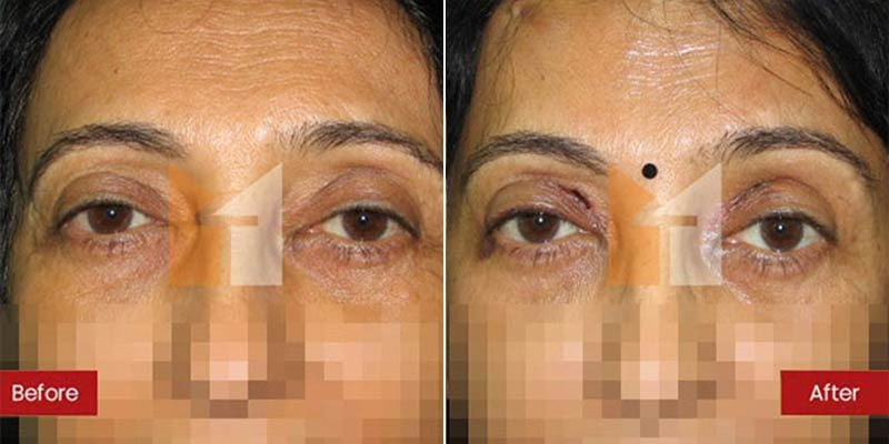 Prof. Dr. Mohan Thomas Aesthetics