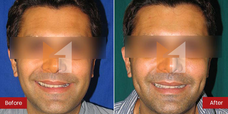 Prof. Dr. Mohan Thomas Aesthetics