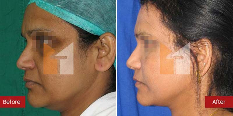 Prof. Dr. Mohan Thomas Aesthetics