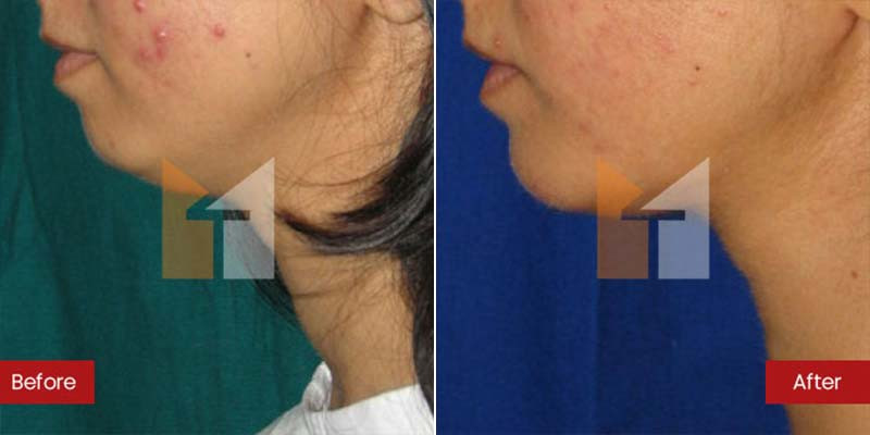 Prof. Dr. Mohan Thomas Aesthetics