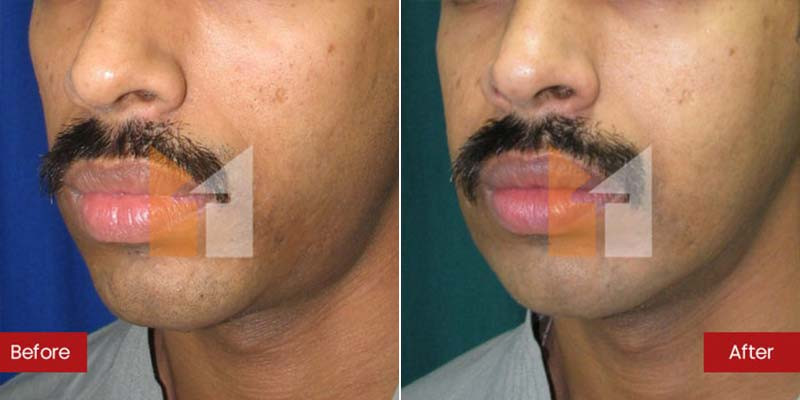 Prof. Dr. Mohan Thomas Aesthetics