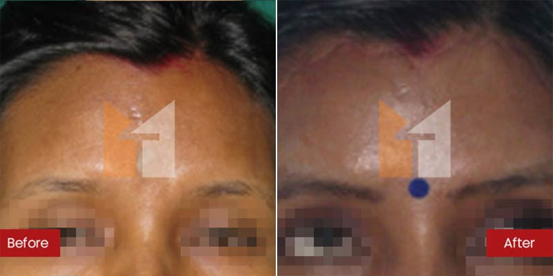 Prof. Dr. Mohan Thomas Aesthetics