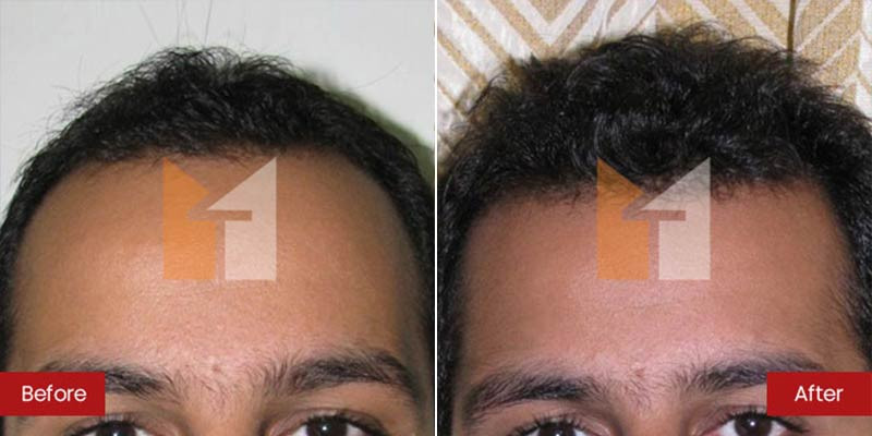 Prof. Dr. Mohan Thomas Aesthetics