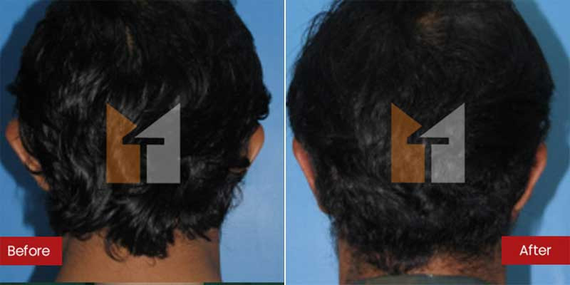 Prof. Dr. Mohan Thomas Aesthetics