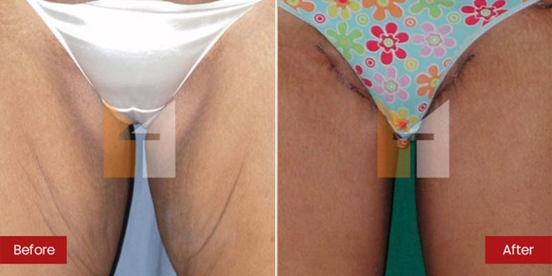 Prof. Dr. Mohan Thomas Aesthetics
