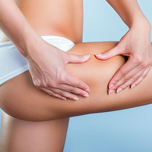 Cellulite Reduction