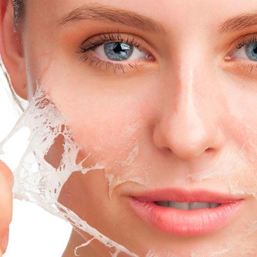 Chemical Peel