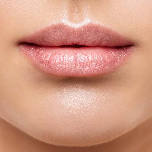 Lip Augmentation